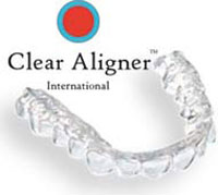 Clear-Aligner